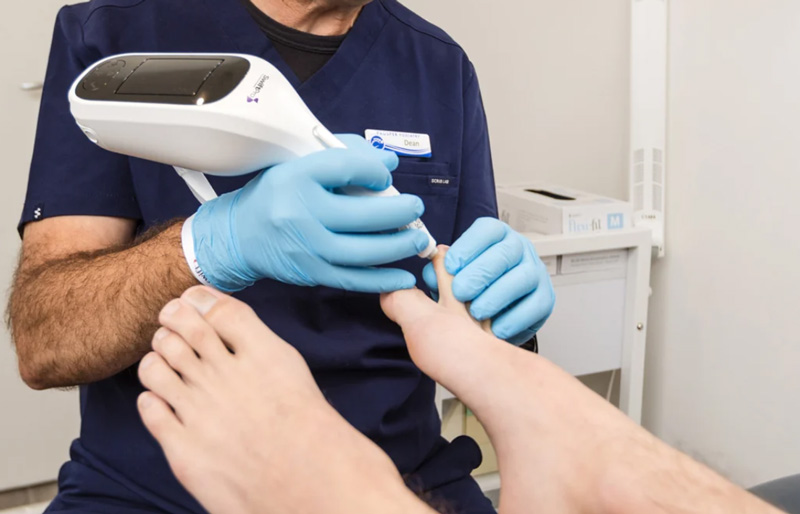 Swift wart treatment Swift wart treatment